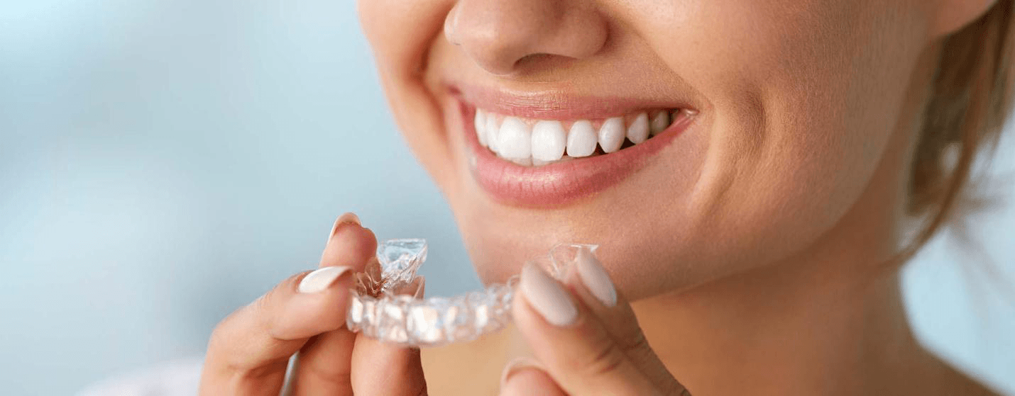 Prozirni aparatić za zube - Inman Aligner, EDC, Esthetic Dental Center