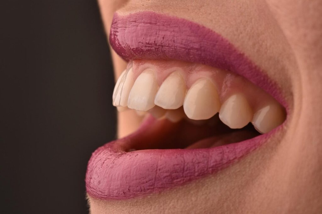 EDC zubne krunice primjer 1