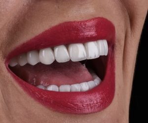 ženska usta s ljuskicama